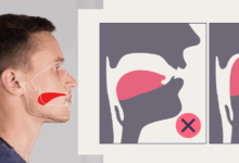 Natural Jawline Improvement Guide Through Proper Tongue Posture