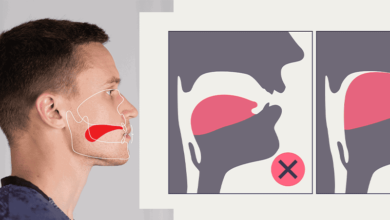 Natural Jawline Improvement Guide Through Proper Tongue Posture